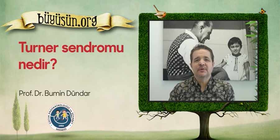 Turner Sendromu - Prof. Dr. Bumin Dündar